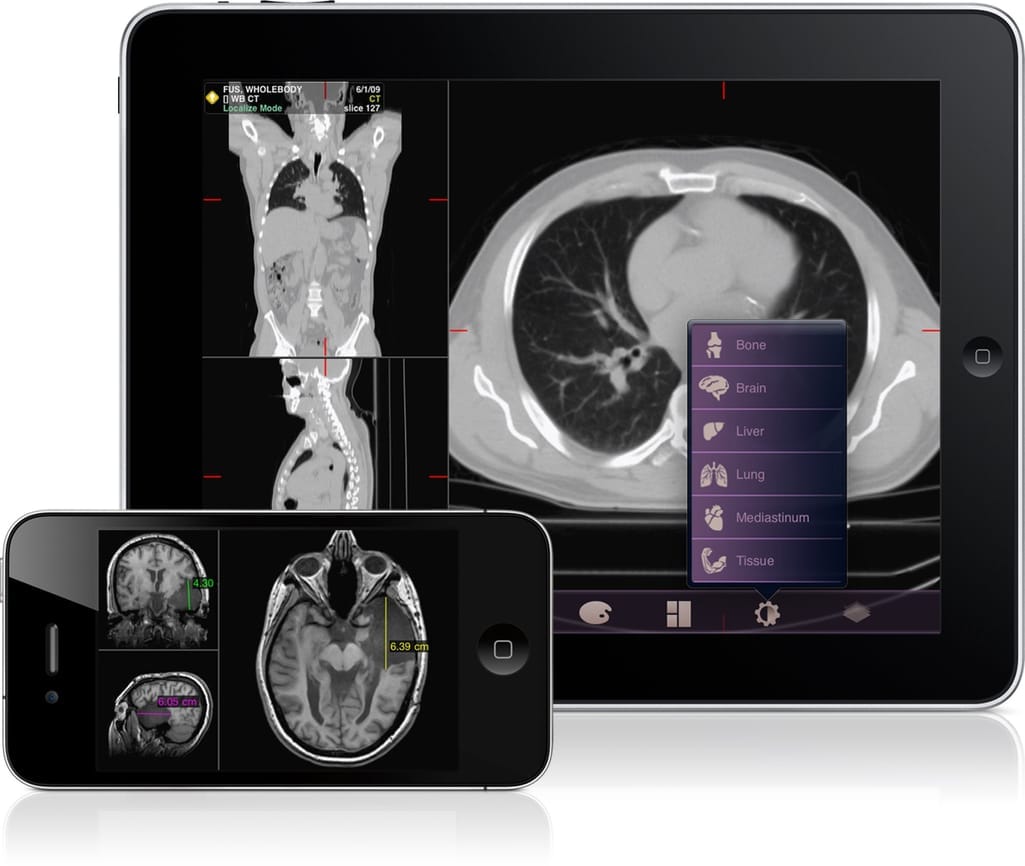 Mobile teleradiology