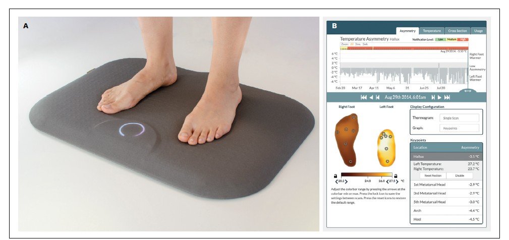 smart pad for foot ulcers detection